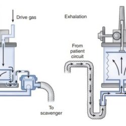 Pop off valve anesthesia machine