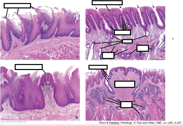 Taste buds circumvallate papilla papillae histology labeled slide gland bacheca scegli una